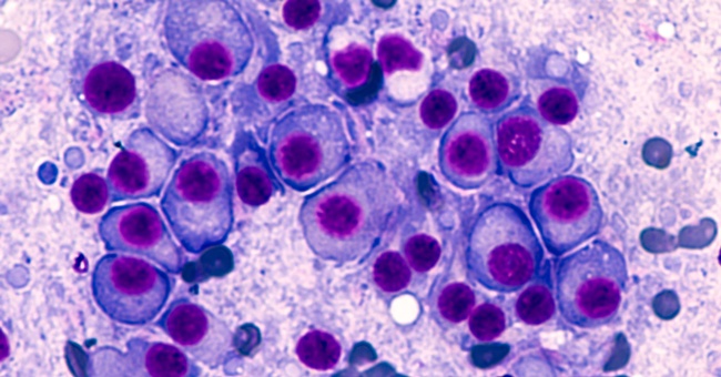 Multiples Myleom © Shutterstock