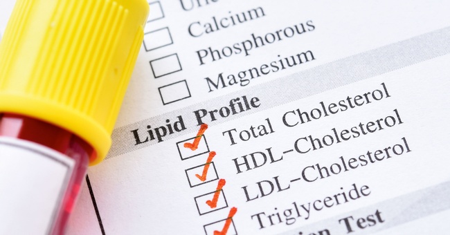 Atorvastatin senkt die LDL- und Triglyceridspiegel sowie das Gesamtcholesterin, während mit einem moderaten Anstieg des HDL zu rechnen ist. © Shutterstock