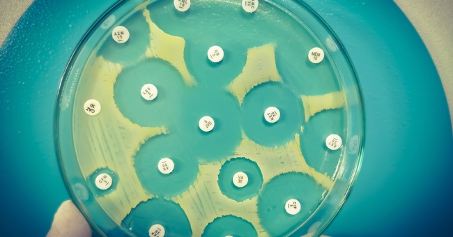 Antibiotikaresistenz-Tests in Kulturplatten. © Shutterstock