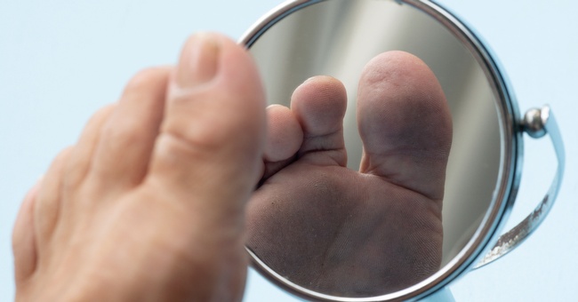 Bei der Untersuchung der Fußunterseite ist ein Spiegel hilfreich. © Shutterstock