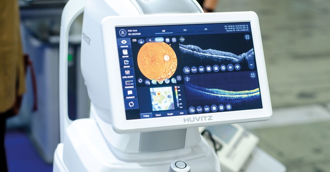 Optische Kohärenztomographie (OCT © Shutterstock