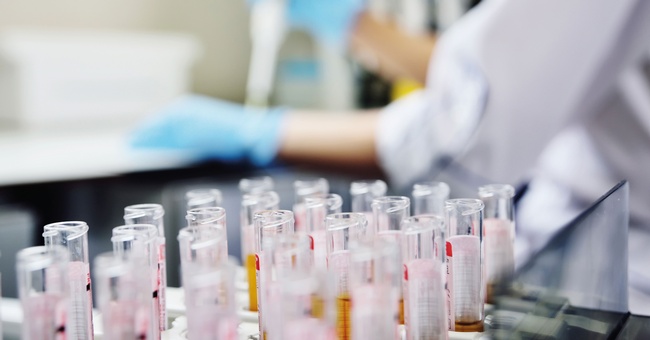 Reagenzgläser © Shutterstock