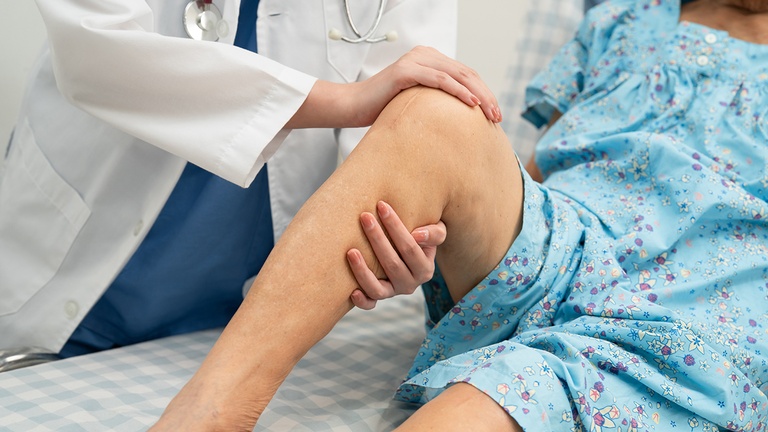 Nach gr&ouml;&szlig;eren orthop&auml;dischen Eingriffen steigt das Risiko f&uuml;r ven&ouml;se Thromboembolien (VTE) deutlich an. &copy; Shutterstock