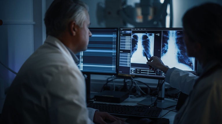 Beim Immuncheckpoint-Inhibitor Serplulimab ist  auf immunvermittelte Nebenwirkungen zu achten. © Shutterstock