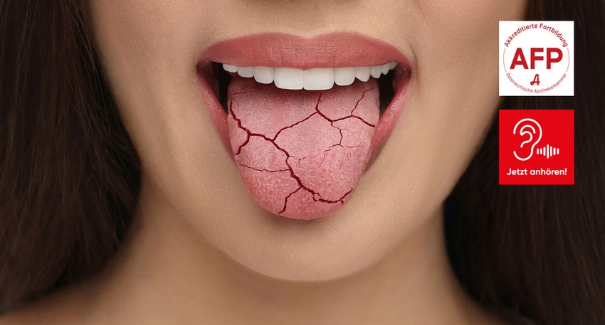 Ianalumab © Shutterstock/APOVERLAG