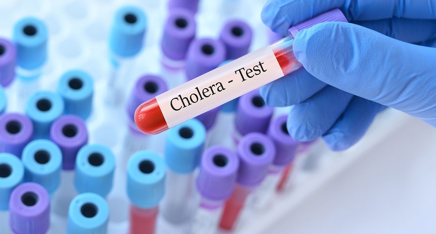 Cholera-Test © Shutterstock
