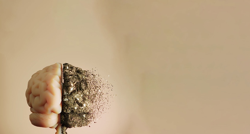 Gehirn &copy; iStock