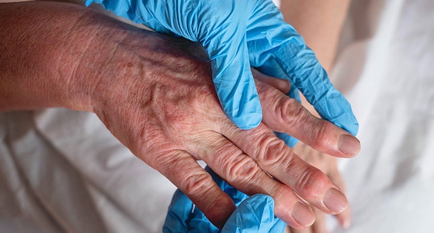 Für Rheumapatient:innen mit kardiovaskulären  Risikofaktoren gilt Naproxen als das günstigste NSAR. © Shutterstock