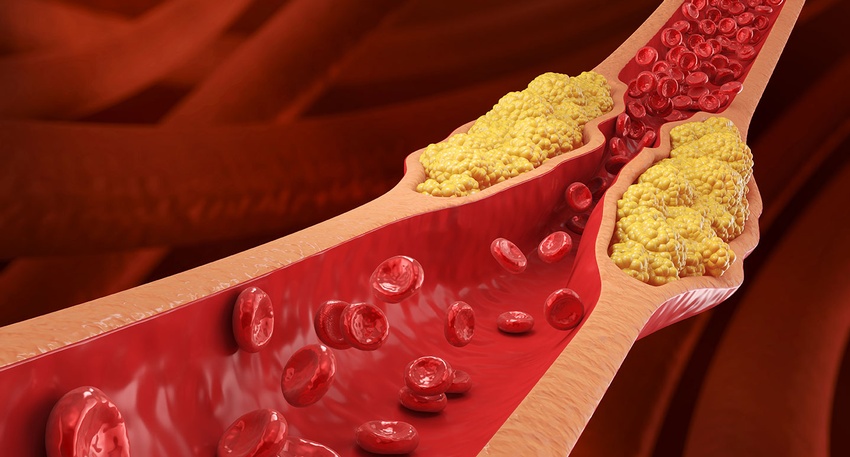 Cholesterinspiegel © shutterstock