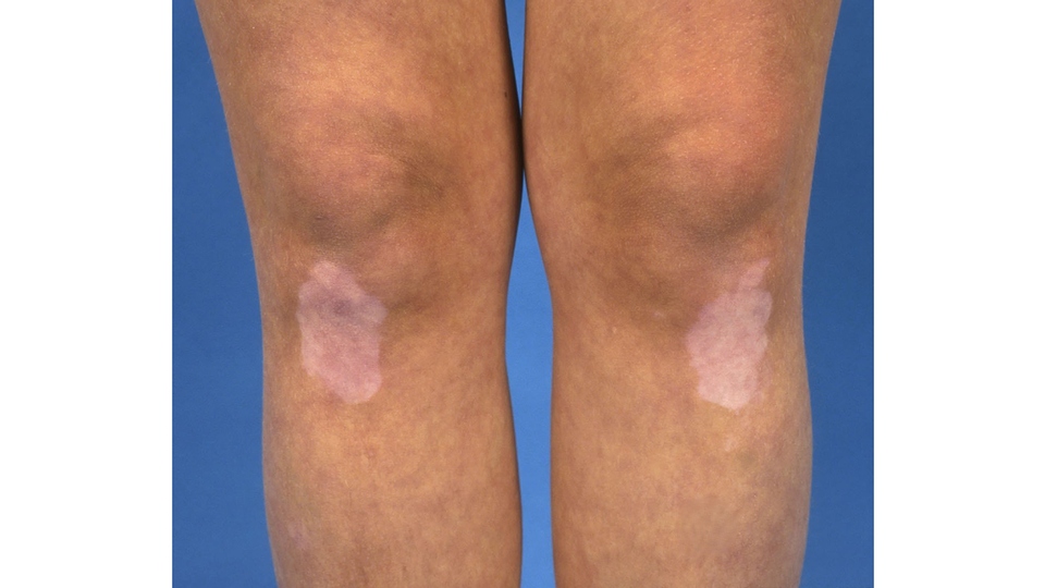 ........ © beigestellt