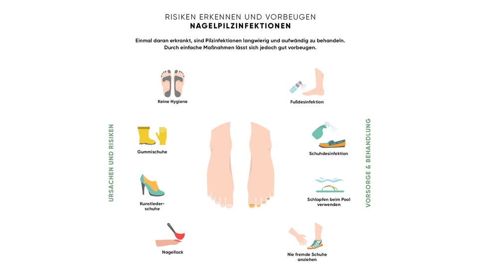 © beigestellt Risiken Nagelpilz © beigestellt