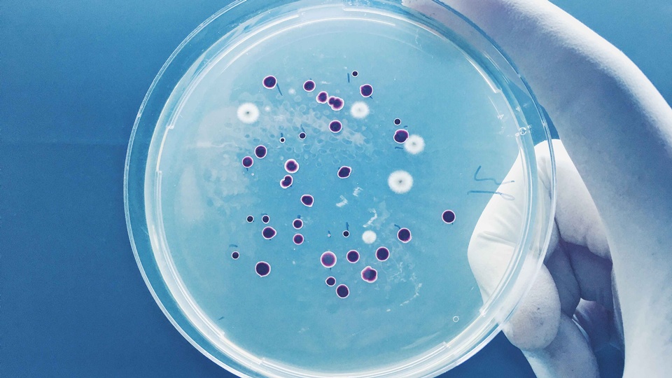 Immer mehr Keime werden gegen Antibiotika resistent. Um die Verbreitung resistenter Keime zu verhindern, sind hygienische Maßnahmen unausweichlich.  © Shutterstock