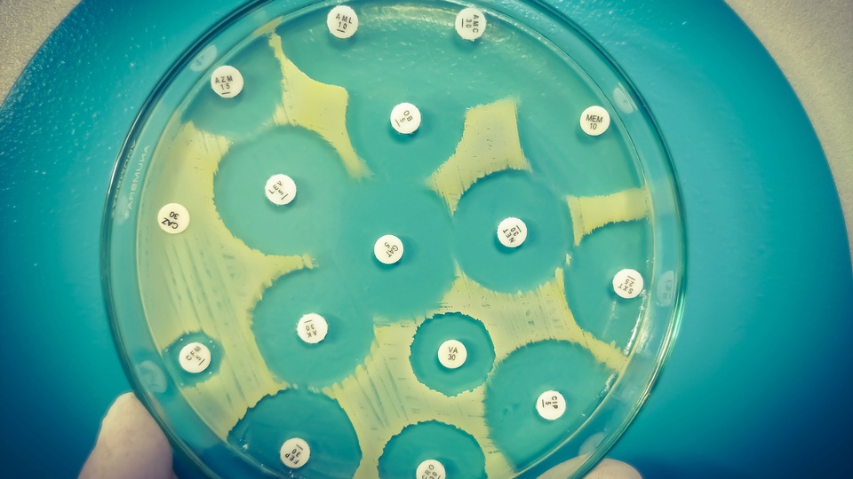 Antibiotikaresistenz-Tests in Kulturplatten. © Shutterstock