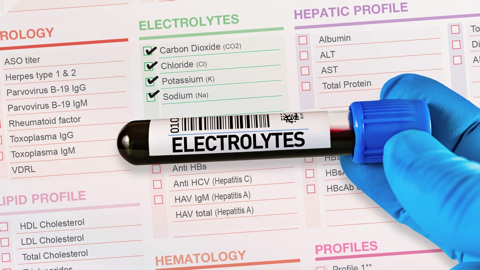 Symbolbild einer Blutprobe auf der das Wort "Elektrolyte" steht. © Shutterstock