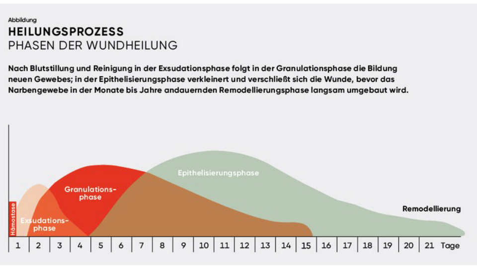 Wundheilung &copy; APOVERLAG