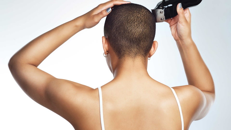 Manche Betroffene entscheiden sich bewusst für eine Glatze und setzen damit ein Statement. © iStock