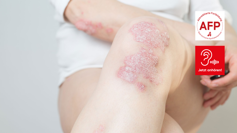 AFP_Audio170226 &copy; Shutterstock/APOVERLAG