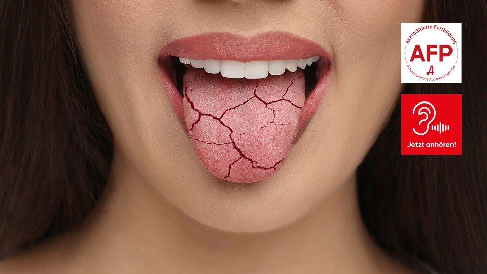 Ianalumab © Shutterstock/APOVERLAG