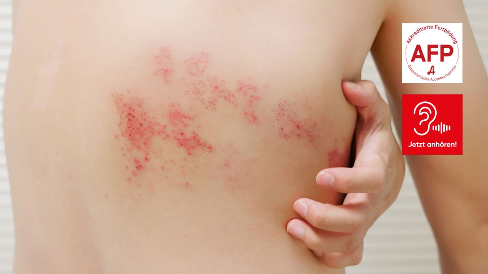 Shutterstock/APOVERLAG &copy; Shutterstock/APOVERLAG