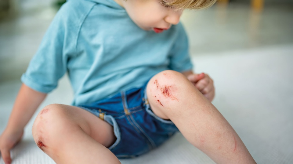 © AdobeStock Wunden behandeln © AdobeStock