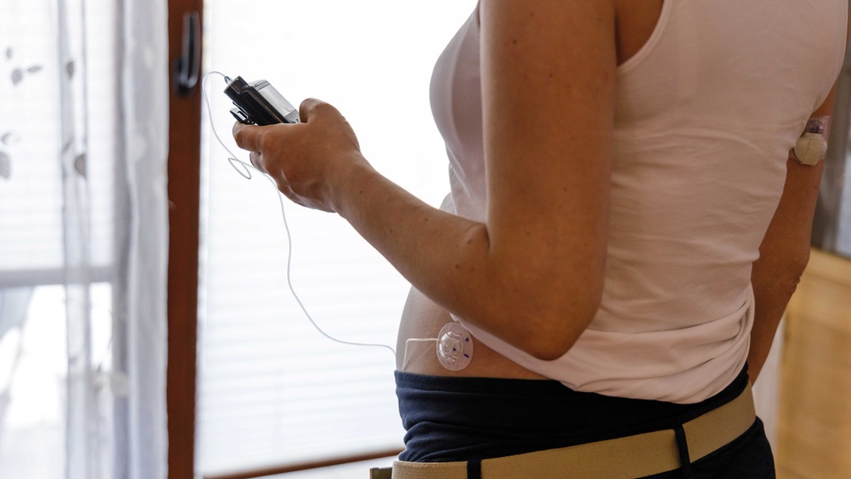 Closed-Loop-Systeme passen die Insulinabgabe automatisch an den Blutzuckerwert an. © Shutterstock