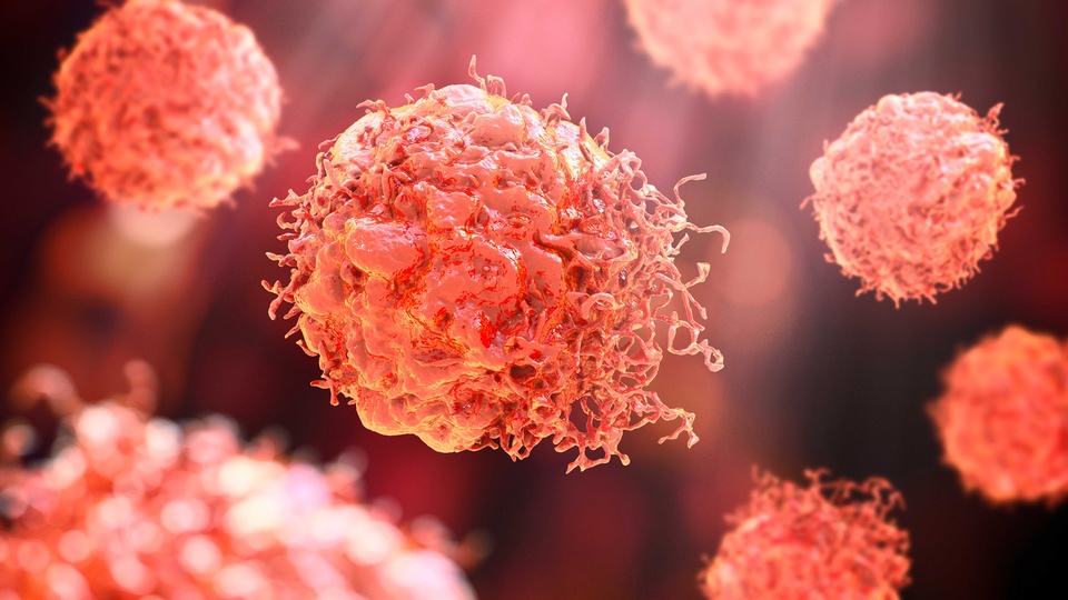 Krebszellen © Shutterstock