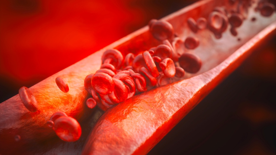 Cholesterin © Shutterstock
