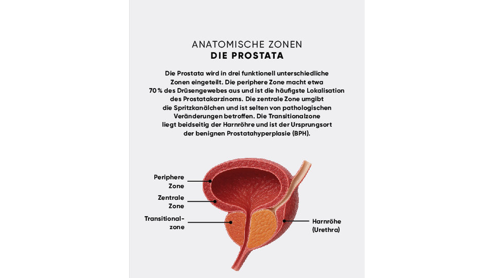 Prostata © APOVERLAG