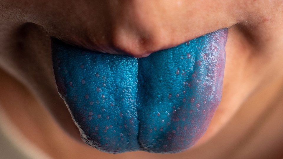 Blaue Zunge © Shutterstock