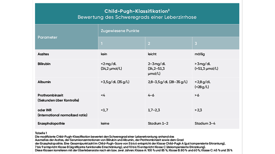 Child-Pugh-Klassifikation © UpToDate, Inc. Child-Pugh classification of severity of cirrhosis (2025)