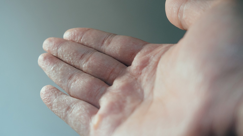 Hand © iStock