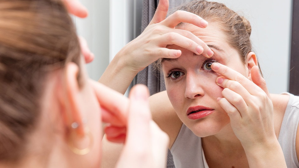 © iStock Kontaktlinsen können das Auge reizen und trockene Augen verursachen. Bei der Anwendung ist eine sorgfältige Hygiene besonders wichtig für die Augengesundheit. © iStock