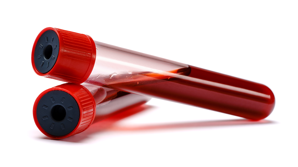 © Shutterstock Blut im Reagenzglas © Shutterstock