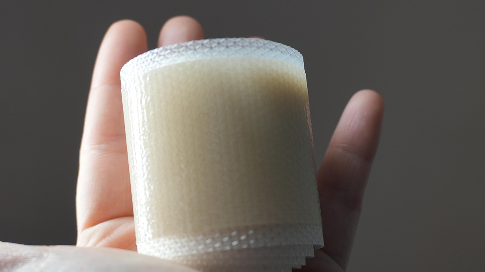 Silikone sind in verschiedenen Formen erh&auml;ltlich, sollten m&ouml;glichst  fr&uuml;h auf frisches Narbengewebe aufgetragen und &uuml;ber einen  l&auml;ngeren Zeitraum (12 bis 24 Wochen) angewendet werden. &copy; shutterstock