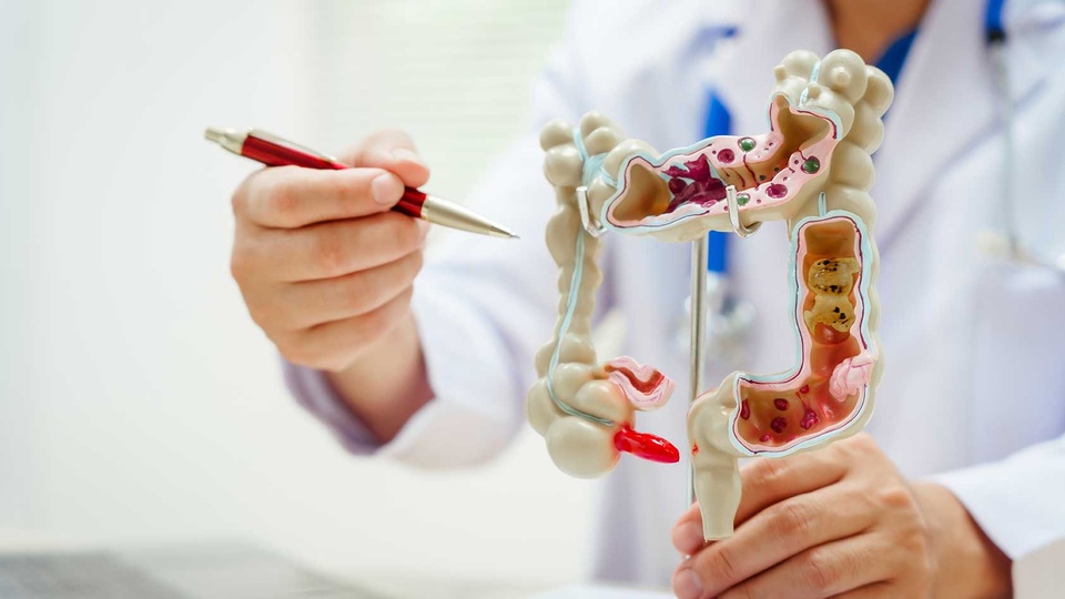 © shutterstock Darmkrebs Vorsorge © shutterstock