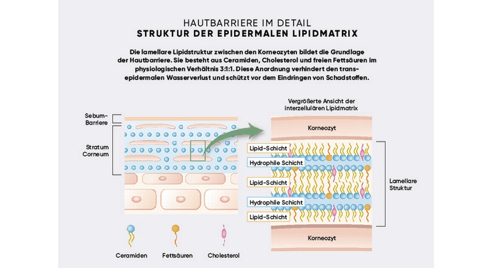 tara Abbildung © APOVERLAG