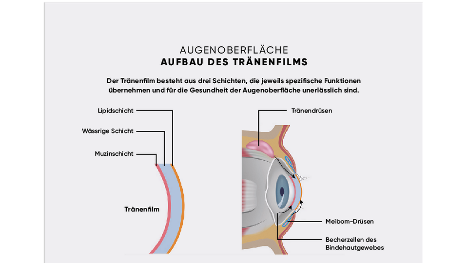 tränenfilm © APOVERLAG